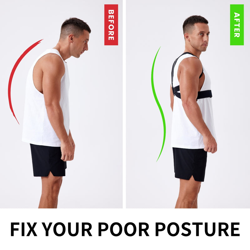 【CS-OS-21】Back Brace Posture Corrector for Scoliosis and Hunchback Correction